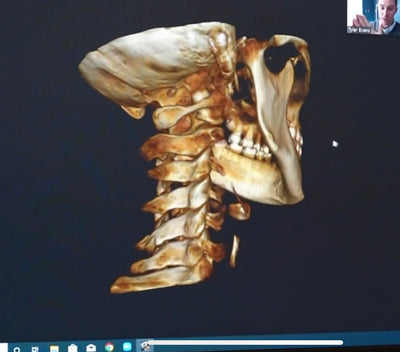 CBCT 3D SCAN - Limitless Chiropractic